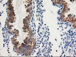 AK3L1 Antibody (OTI3B1), Novus Biologicals 0.1mL; Unlabeled:Antibodies,