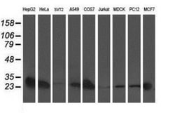 AK3L1 Antibody (OTI3B1), Novus Biologicals 0.1mL; Unlabeled:Antibodies,
