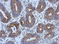 AK3L1 Antibody, Novus Biologicals 0.1mL; Unlabeled:Antibodies, Polyclonal