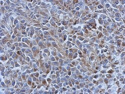 AK3L1 Antibody, Novus Biologicals 0.1mL; Unlabeled:Antibodies, Polyclonal