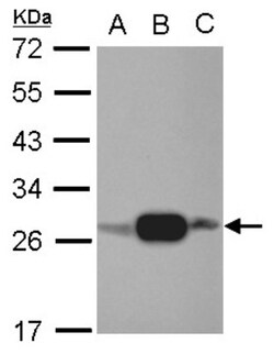 AK3L1 Antibody, Novus Biologicals 0.1mL; Unlabeled:Antibodies, Polyclonal
