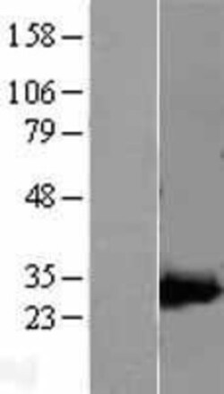Novus Biologicals&trade;&nbsp;AK3L1 Overexpression Lysate
