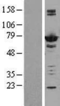 Novus Biologicals™ AK5 Overexpression Lysate