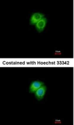 AK7 Antibody, Novus Biologicals 0.1mg; Unlabeled:Antikörper