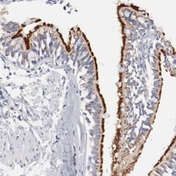 AK7 Antibody, Novus Biologicals 25 &mu;L; Unlabeled:Antibodies, Polyclonal