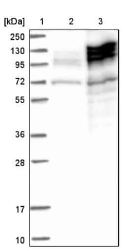 AKAP1 Antibody, Novus Biologicals 25 &mu;L | Buy Online | Novus Biologicals | Fisher Scientific