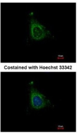 AKAP10 Antibody, Novus Biologicals 0.1mL; Unlabeled:Antibodies, Polyclonal