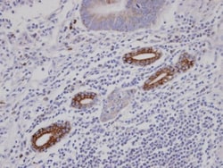 AKAP10 Antibody, Novus Biologicals 0.1mL; Unlabeled:Antibodies, Polyclonal