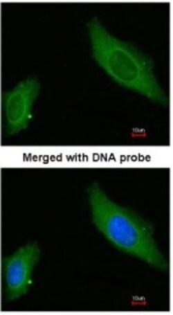 AKAP12 Antibody, Novus Biologicals 0.1mL; Unlabeled:Antibodies, Polyclonal