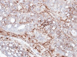 AKAP12 Antibody, Novus Biologicals 0.1mL; Unlabeled:Antibodies, Polyclonal