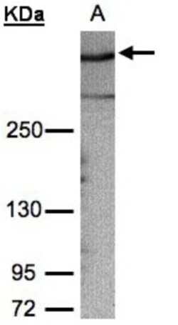 AKAP12 Antibody, Novus Biologicals 0.1mL; Unlabeled:Antibodies, Polyclonal