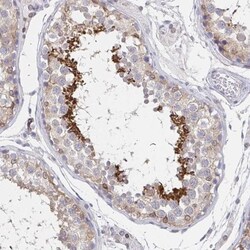 AKAP14 Antibody, Novus Biologicals 25 &mu;L, Unlabeled:Antibodies, Polyclonal