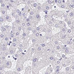 AKAP14 Antibody, Novus Biologicals 25 &mu;L, Unlabeled:Antibodies, Polyclonal