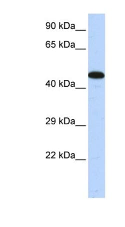AKAP5 Antibody, Novus Biologicals 100&mu;L; Unlabeled:Antibodies, Polyclonal