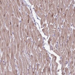 AKAP6 Antibody, Novus Biologicals 0.1mL; Unlabeled:Antibodies, Polyclonal