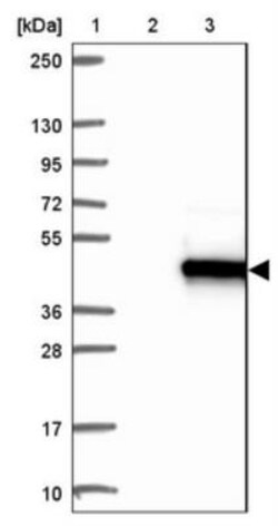 AKAP7 Antibody, Novus Biologicals 0.1mL; Unlabeled:Antibodies, Polyclonal