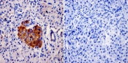 AKAP9 Antibody (17G10), Novus Biologicals 0.1mg; Unlabeled:Antibodies,