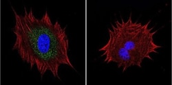 AKAP9 Antibody (17G10), Novus Biologicals 0.1mg; Unlabeled:Antibodies,