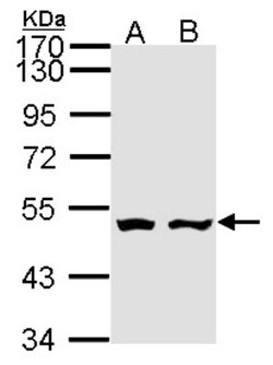 AKD1 Antibody, Novus Biologicals 0.1mL; Unlabeled:Antibodies, Polyclonal