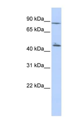AKD1 Antibody, Novus Biologicals 100&mu;L; Unlabeled:Antibodies, Polyclonal