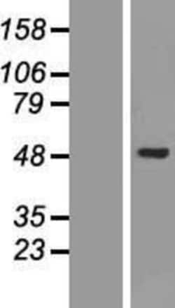 Novus Biologicals&trade;&nbsp;AKD1 Overexpression Lysate