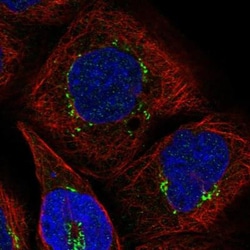 AKD1 Antibody, Novus Biologicals 25 &mu;L; Unlabeled:Antibodies, Polyclonal