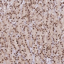 AKD1 Antibody, Novus Biologicals 25 &mu;L | Buy Online | Novus Biologicals | Fisher Scientific