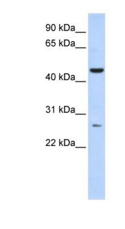 AKD1 Antibody, Novus Biologicals 100 &mu;L | Buy Online | Novus Biologicals | Fisher Scientific