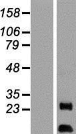 Novus Biologicals&trade;&nbsp;AKIP Overexpression Lysate