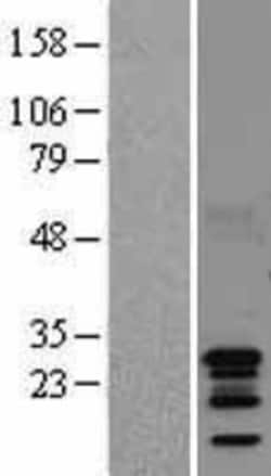 Novus Biologicals&trade;&nbsp;BCA3 Overexpression Lysate