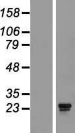 Novus Biologicals™ BCA3 Overexpression Lysate