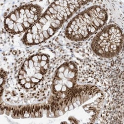 AKIP Antibody, Novus Biologicals:Antibodies:Primary Antibodies