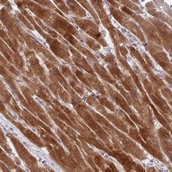 AKIRIN1 Antibody, Novus Biologicals 25ul | Buy Online | Novus Biologicals | Fisher Scientific