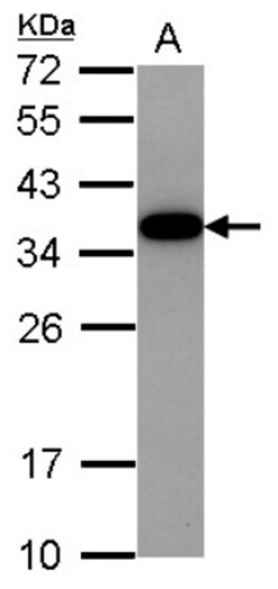 Akirin2 Antibody, Novus Biologicals 0.1mL; Unlabeled:Antibodies, Polyclonal