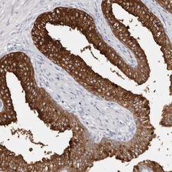 AKNAD1 Antibody, Novus Biologicals 25 &mu;L | Buy Online | Novus Biologicals | Fisher Scientific