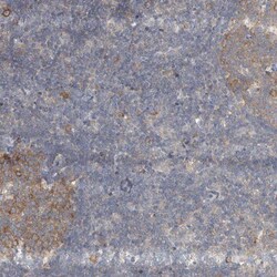 AKNAD1 Antibody, Novus Biologicals:Antibodies:Primary Antibodies