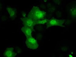 AKR1A1 Antibody (OTI6E3), Novus Biologicals 0.1mL; Unlabeled:Antibodies,