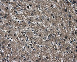 AKR1A1 Antibody (OTI6E3), Novus Biologicals 0.1mL; Unlabeled:Antibodies,