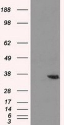 AKR1A1 Antibody (OTI6E3), Novus Biologicals 0.1mL; Unlabeled:Antibodies,