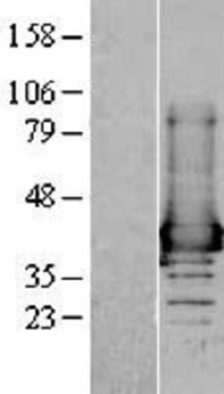 Novus Biologicals™ AKR1A1 Overexpression Lysate