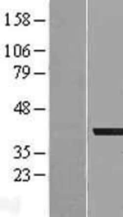 Novus Biologicals&trade;&nbsp;AKR1A1 Overexpression Lysate