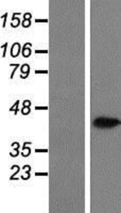 Novus Biologicals&trade;&nbsp;Aldo-keto Reductase 1C3/AKR1C3 Overexpression Lysate