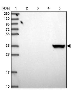 Aldo-keto Reductase 1C4/AKR1C4 Antibody, Novus Biologicals 0.1mL; Unlabeled:Antibodies,