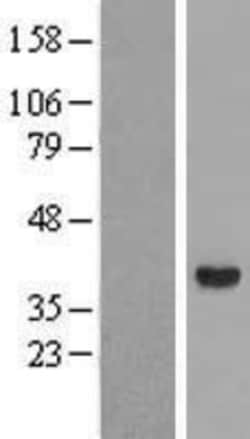 Novus Biologicals™ Aldo-keto Reductase 1C4/AKR1C4 Overexpression Lysate