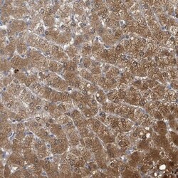 Aldo-keto Reductase 1C4/AKR1C4 Antibody, Novus Biologicals 0.1mL; Unlabeled:Antibodies,