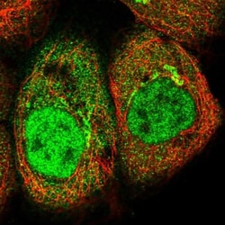 AKR1CL2 Antibody, Novus Biologicals 0.1mL; Unlabeled:Antibodies, Polyclonal