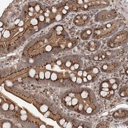 AKR1CL2 Antibody, Novus Biologicals 0.1mL; Unlabeled:Antibodies, Polyclonal