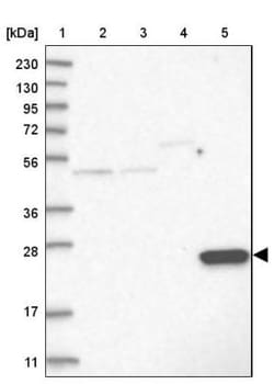 AKR1CL2 Antibody, Novus Biologicals 0.1mL; Unlabeled:Antibodies, Polyclonal