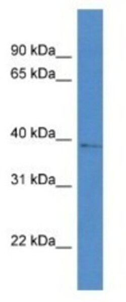 AKR1D1 Antibody, Novus Biologicals 100&mu;L; Unlabeled:Antibodies, Polyclonal