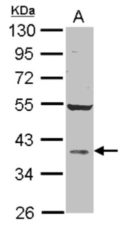 AKR1D1 Antibody, Novus Biologicals 0.1mL; Unlabeled:Antibodies, Polyclonal
